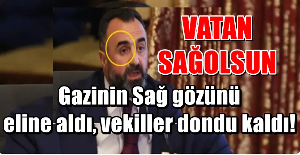 Gazinin Sağ gözünü  eline aldı, vekiller dondu kaldı!
